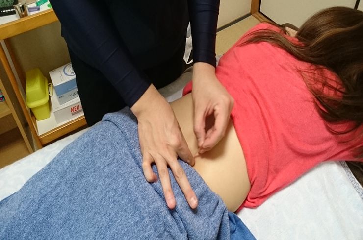 鍼治療